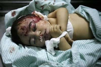 Palestinian infant victim of Israeli Operation Cast Lead
