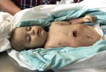Baby killed during Israeli Operation Cast Lead